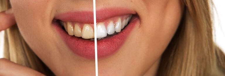 teeth, dental care, white